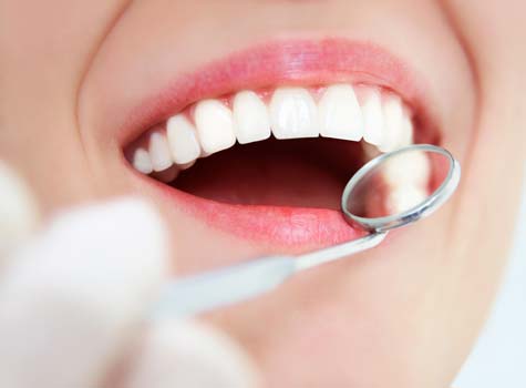 Delta dental in network dentist