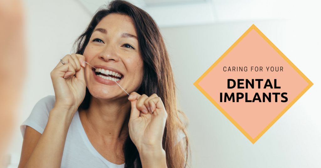 Caring For Your Dental Implants
