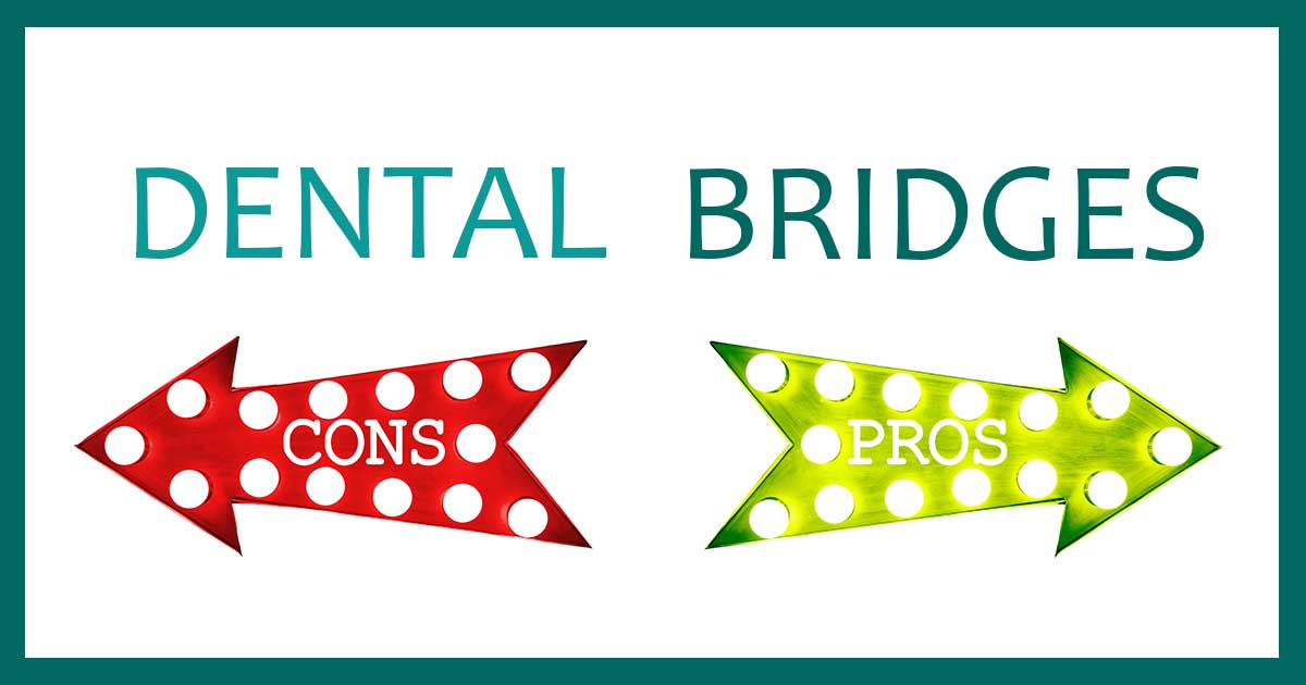 Berkeley Dental Office: Pros & Cons of Dental Bridges